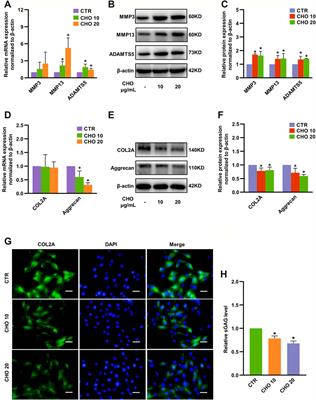 Cholesterol Induces Pyroptosis and Matrix Degradation via mSREBP1-Driven Endoplasmic Reticulum Stress in Intervertebral Disc Degeneration